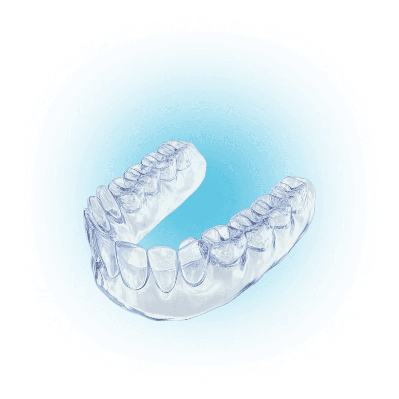 Установка элайнеров